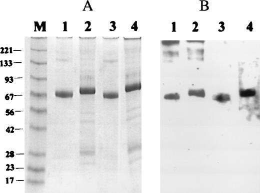 Fig. 4. Western blots of Thr-145 and Met-145 forms of recombinant glycoprotein (GP)Ib under reducing and nonreducing conditions. / (A) Coomassie blue stain of recombinant GPIbα under nonreducing conditions (Thr-145, lane 1, and Met-145, lane 3) or reducing conditions (Thr-145, lane 2, and Met-145, lane 4). (B) Western blot of duplicate of panel A with anti-human platelet antigen (HPA)-2a (lanes 1 and 2), and anti-HPA-2b (lanes 3 and 4).