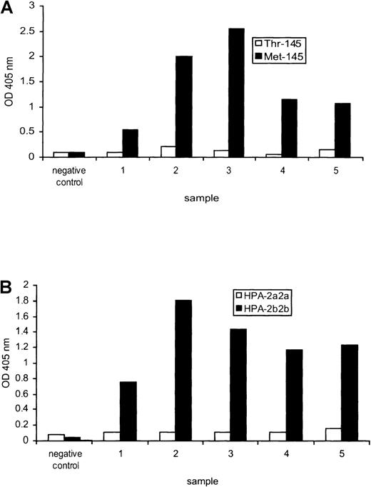 Fig. 5. Comparison between recombinant and platelet-derived glycoprotein (GP)Ib for human platelet antigen (HPA)-2 antibody detection. / (A) An inert negative control serum and five different sera containing anti-HPA-2b tested against the Thr-145 and Met-145 forms of recombinant GPIbα by enzyme-linked immunoabsorbent assay. (B) The same sera tested against platelet-derived GPIbα by monoclonal antibody-specific immobilization of platelet antigens.