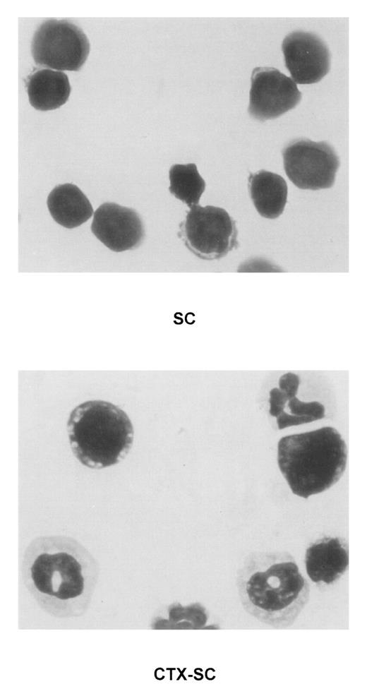 Fig. 6. Presence of immature myeloid cell in CTX-SC. / Giemsa staining was performed in cytospin preparations of concentrated fresh SC of PBS-injected (top, SC) or CTX-injected (bottom, CTX-SC) mice 6 days after the last dose of CTX. Samples were analyzed using an Olympus Vanox AHBT3 microscope, original magnification ×1000.