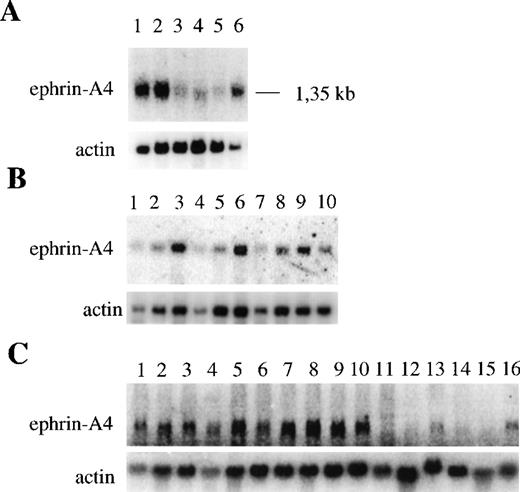 Fig. 2. Expression of ephrin-A4 mRNA in different human tissues and cell types. / Upper panels show ephrin-A4 hybridization; lower panels, β-actin hybridization. (A) Expression in different hematopoietic tissues: (1) spleen, (2) lymph node, (3) thymus, (4) peripheral blood leukocytes, (5) bone marrow, and (6) fetal liver. (B) Expression in freshly isolated, cultured B and T lymphocytes: (1) peripheral blood B cells, (2) 24-hour TPA-stimulated blood B cells, (3) 24-hour anti-μ–stimulated blood B cells, (4) peripheral blood CD4+ T cells, (5) 24-hour TPA-stimulated blood CD4+ T cells, (6) 24-hour anti-CD3–stimulated blood CD4+ T cells, (7) peripheral blood CD8+ T cells, (8) 24-hour anti-CD3–stimulated blood CD8+ T cells, (9) tonsil B cells, and (10) tonsil T cells. (C) Expression in hematopoietic cell lines: (1) Tom-1, (2) BV173, (3) Reh, (4) Nalm-6, (5) Daudi, (6) Bjab, (7) U266, (8) U698, (9) JM, (10) Jurkat, (11) HPB ALL, (12) JY, (13) KG1-A, 914) HL60, (15) U937, and (16) K562.
