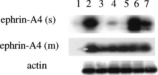 Fig. 3. Semiquantitative PCR analysis of the expression of ephrin-A4 (m) and ephrin-A4 (s) mRNA in freshly isolated and stimulated B and T lymphocytes. / (1) water control, (2) Reh pro-B cells, (3) tonsil T lymphocytes, (4) 24-hour anti-CD3– stimulated CD8+ blood T lymphocytes, (5) 24-hour anti-CD3–stimulated CD4+ blood T lymphocytes, (6) tonsil B lymphocytes, and (7) 24-hour anti-μ–stimulated blood B cells. The upper panel shows ephrin-A4 (s) specific PCR (28 cycles); the middle panel, ephrin-A4 (m) specific PCR (30 cycles); and the lower panel, β-actin specific PCR (24 cycles).