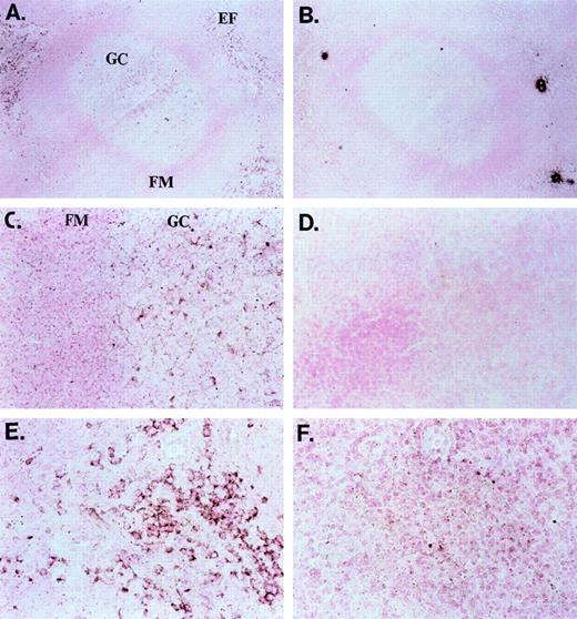 Fig. 4. In situ (mRNA) hybridization of tonsil sections with ephrin-A4 probe and control probe. / (A, B) Overview of a germinal center (GC) and extrafollicular area; objective ×25. (C, D) Close-up of a germinal center with follicular mantle (FM) zone; objective ×40. (E, F) Close-up of an extrafollicular (EF) area; objective ×40. Panels A, C, and E show the ephrin-A4 Dig-labeled probe, and panels B, D, and F, the control Dig-labeled probe. Brown staining shows ephrin-A4 mRNA hybridization in the GC and EF areas.