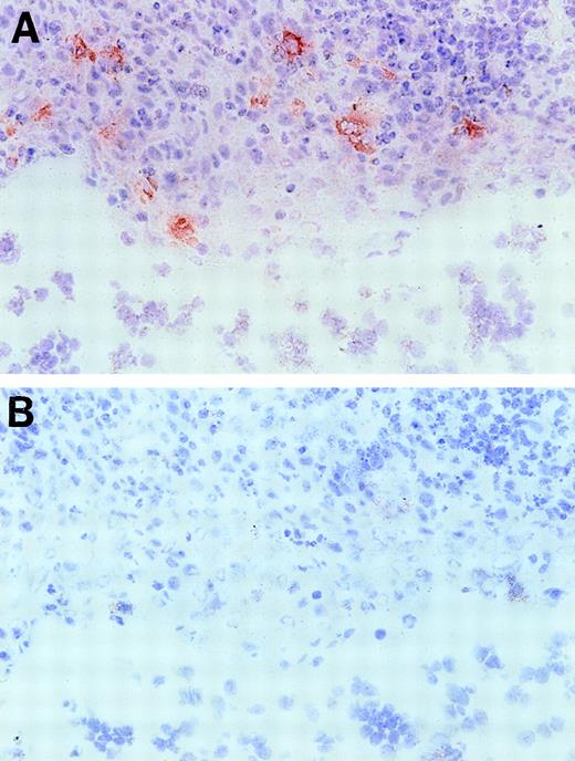 Fig. 9. Immunohistochemical staining of a tonsil section with anti-EphA2 antibodies. / Frozen tonsil sections were stained with EphA2 specific antiserum (A) or normal rabbit serum Ig (B) (objective ×40. Red EphA2+ cells are present in the tonsil crypt area only.