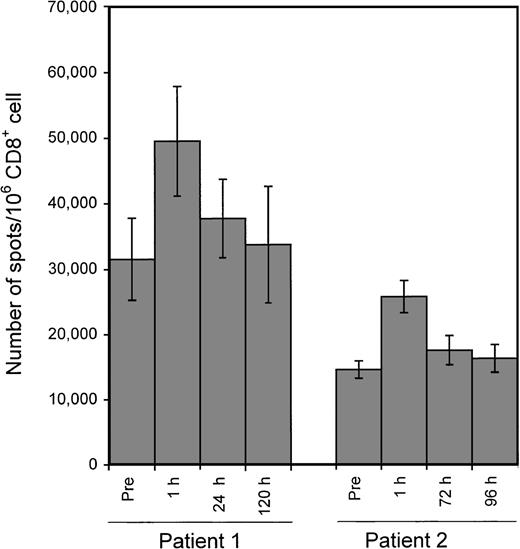 Fig. 7. Application of the ELISPOT assay to the monitoring of changes in the number of LCL-responsive CD8+ cells following adoptive CTL infusion. / Two patients with PTLD received EBV-specific polyclonal CTL infusion from partially matched donors. The HLA types of patients and donors were: patient 1 (A1, 24, B7, 8), donor for patient 1 (A1, 33, B8, 17); patient 2 (A2, 32, B13, 27), donor for patient 2 (A2, 3, B7, 27). Blood was drawn immediately before and at the indicated time points after infusion. CD8+ cells were used as responders in ELISPOT assays with the patient's LCLs as stimulators. Each bar represents the mean ± SD of triplicate wells.