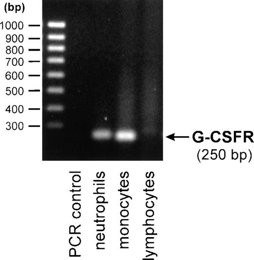 Fig. 4. Detection of human G-CSF receptor mRNA by RT-PCR. / Total mRNA from purified neutrophils, monocytes, or lymphocytes was reverse transcribed and amplified by 19 cycles of PCR using G-CSF receptor-specific primers. PCR products were analyzed on a 1.5% agarose gel and visualized by ethidium bromide staining.