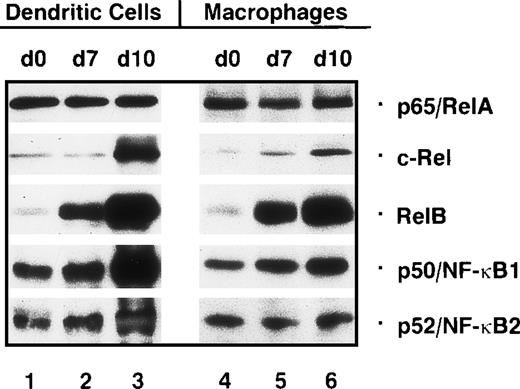 Fig. 2. Nuclear Rel proteins are differentially expressed during generation and maturation of human dendritic cells and development of macrophages in vitro. / Immunoblots were performed with nuclear proteins from monocytes (day 0, lanes 1 and 4), immature dendritic cells (day 7, lane 2), mature dendritic cells (day 10, lane 3), differentiated macrophages (day 7, lane 5), and macrophages treated with monocyte-conditioned medium for another 3 days (day 10, lane 6). Proteins were separated on an 8% sodium dodecyl sulfate–polyacrylamide gel and electrophoretically transferred to a nitrocellulose membrane.