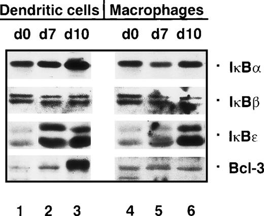 Fig. 4. The concentration of Bcl-3 is strongly increased in mature dendritic cells. / Immunoblots with cytoplasmic proteins from monocytes (day 0, lanes 1 and 4), immature dendritic cells (day 7, lane 2), mature dendritic cells (day 10, lane 3), macrophages (day 7, lane 5), and macrophages treated with monocyte-conditioned medium for another 3 days (day 10, lane 6).