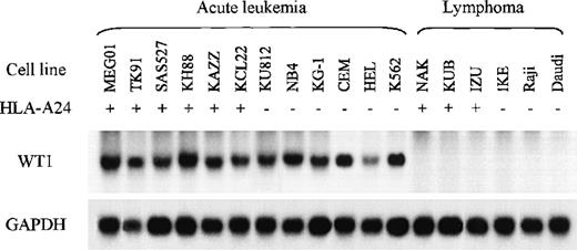 Fig. 2. Northern blot analysis of WT1 mRNAs in various leukemia and lymphoma cell lines. / Samples of total cellular RNA were hybridized with a32P-labeled WT1 cDNA probe (top), and each sample blot was also hybridized with a GAPDH cDNA probe (bottom).