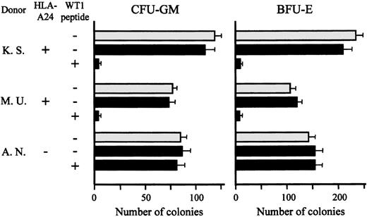 Fig. 5. Lack of effect of TAK-1 on colony formation by normal bone marrow cells. / The numbers of CFU-GM and BFU-E generated from normal bone marrow cells, which had been treated or not treated with WT1 peptide and then cocultured with (black bars) or without (gray bars) TAK-1, are shown. Cells in triplicate wells were cultured, and the data are expressed as mean colony counts ± standard deviation.