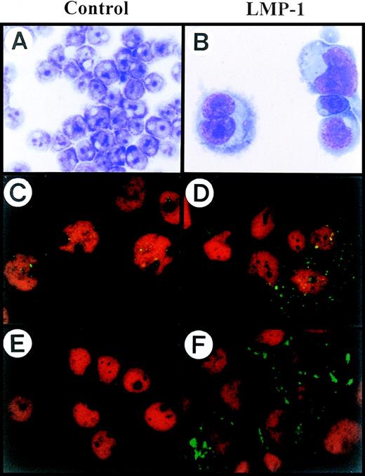 Fig. 1. H-RS phenotype generated by LMP-1 overexpression in IM9 cells. / (A, B) Both Vec-TF (A) and LMP-1-TF (B) IM9 cells were morphologically examined with Wright’s and Giemsa staining. LMP-1 overexpressing IM9 cells showed typical H-RS morphology. (C, D) Vec-TF (C) IM9 cells and LMP-1-TF (D) IM9 cells were stained with anti–LMP-1 monoclonal antibody. LMP-1 expression was identified by incubation with FITC-conjugated goat anti-mouse antibody, and then was analyzed by confocal microscopy. Vec-TF cells showed minimal expression of LMP-1. (E, F) Vec-TF (E) IM9 cells and LMP-1-TF (F) IM9 cells were stained with FITC-conjugated anti-CD15 monoclonal antibody. While no CD15 expression was detectable in Vec-TF cells, the majority of enlarged LMP-1-TF cells showed relatively high expression of CD15 in Golgi and cytoplasmic regions. PI staining was included for nuclear staining in all samples except A and B. All slides were processed in parallel and photographed under identical magnification (original magnification ×630).