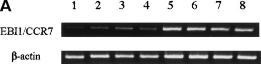 Fig. 1. Analyses for CCR7/EBI1 expression. / (A) Reverse transcriptase-polymerase chain reaction (RT-PCR) analysis for CCR7/EBI1 expression. PCR amplification of the CCR7/EBI1 and β-actin–specific products in control CD4+CD45RO+ T cells (lane 1), freshly isolated adult T-cell leukemia (ATL) cells without (lanes 2, 3, and 4; patients 7, 10, and 6, respectively) and with lymphoid organ involvement (lanes 5, 6, 7, and 8; patients 27, 26, 24, and 23, respectively) was performed for 28 PCR cycles. (B) RT-PCR analysis for CCR7/EBI1 expression in freshly isolated ATL cells from patients with and without lymphoid organ involvement. CCR7/EBI1 expression was evaluated with the ratio of CCR7/β-actin–specific product for control CD4+CD45RO+ T cells obtained from the peripheral blood of 8 healthy volunteers (A, closed squares), ATL cells from 12 patients without lymphoid organ involvement (B, open circles; patients 1 through 12), and ATL cells from 16 patients with lymphoid organ involvement (C, open circles; patients 13 through 28). RT-PCR analyses were performed independently in triplicate. (C) Flow cytometric analysis for CCR7/EBI1 expression on freshly isolated ATL cells from patients with and without lymphoid organ involvement. Flow cytometric analysis of control CD4+CD45RO+ T cells and freshly isolated ATL cells was performed with anti-CCR7 mAb, CCR7.6B3. Each point shows the mean fluorescence intensity (MFI) for CCR7/EBI1 staining, which was corrected by substrating MFI obtained with the nonbinding control IgG1 mouse mAb. Each point of group A indicates the MFI for CCR7/EBI1 staining of CCR7/EBI1-positive CD4+CD45RO+ T cells because CCR7/EBI1-positive cells were 55% ± 14% of control CD4+CD45RO+ T cells isolated from 8 healthy volunteers. The bars indicate the mean value of each group; the statistical analysis was performed using Student t test. (D) Flow cytometric analysis for CXCR4 expression on freshly isolated ATL cells from patients with and without lymphoid organ involvement. Flow cytometric analysis of control CD4+CD45RO+ T cells and freshly isolated ATL cells was performed with anti-CXCR4 mAb. Each point shows the MFI for CXCR4 staining, which was corrected by substrating MFI obtained with the nonbinding control IgG2amouse mAb. Each point of group A indicates the MFI for CXCR4 staining of CXCR4-positive CD4+CD45RO+ T cells because CXCR4-positive cells were 76% ± 18% of control CD4+CD45RO+ T cells isolated from 8 healthy volunteers. The bars indicate the mean value of each group; the statistical analysis was performed using Student t test.