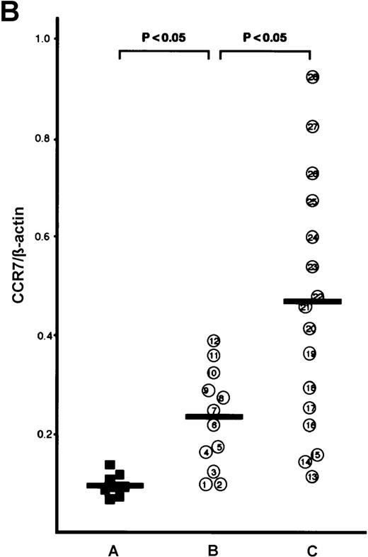 Fig. 1. Analyses for CCR7/EBI1 expression. / (A) Reverse transcriptase-polymerase chain reaction (RT-PCR) analysis for CCR7/EBI1 expression. PCR amplification of the CCR7/EBI1 and β-actin–specific products in control CD4+CD45RO+ T cells (lane 1), freshly isolated adult T-cell leukemia (ATL) cells without (lanes 2, 3, and 4; patients 7, 10, and 6, respectively) and with lymphoid organ involvement (lanes 5, 6, 7, and 8; patients 27, 26, 24, and 23, respectively) was performed for 28 PCR cycles. (B) RT-PCR analysis for CCR7/EBI1 expression in freshly isolated ATL cells from patients with and without lymphoid organ involvement. CCR7/EBI1 expression was evaluated with the ratio of CCR7/β-actin–specific product for control CD4+CD45RO+ T cells obtained from the peripheral blood of 8 healthy volunteers (A, closed squares), ATL cells from 12 patients without lymphoid organ involvement (B, open circles; patients 1 through 12), and ATL cells from 16 patients with lymphoid organ involvement (C, open circles; patients 13 through 28). RT-PCR analyses were performed independently in triplicate. (C) Flow cytometric analysis for CCR7/EBI1 expression on freshly isolated ATL cells from patients with and without lymphoid organ involvement. Flow cytometric analysis of control CD4+CD45RO+ T cells and freshly isolated ATL cells was performed with anti-CCR7 mAb, CCR7.6B3. Each point shows the mean fluorescence intensity (MFI) for CCR7/EBI1 staining, which was corrected by substrating MFI obtained with the nonbinding control IgG1 mouse mAb. Each point of group A indicates the MFI for CCR7/EBI1 staining of CCR7/EBI1-positive CD4+CD45RO+ T cells because CCR7/EBI1-positive cells were 55% ± 14% of control CD4+CD45RO+ T cells isolated from 8 healthy volunteers. The bars indicate the mean value of each group; the statistical analysis was performed using Student t test. (D) Flow cytometric analysis for CXCR4 expression on freshly isolated ATL cells from patients with and without lymphoid organ involvement. Flow cytometric analysis of control CD4+CD45RO+ T cells and freshly isolated ATL cells was performed with anti-CXCR4 mAb. Each point shows the MFI for CXCR4 staining, which was corrected by substrating MFI obtained with the nonbinding control IgG2amouse mAb. Each point of group A indicates the MFI for CXCR4 staining of CXCR4-positive CD4+CD45RO+ T cells because CXCR4-positive cells were 76% ± 18% of control CD4+CD45RO+ T cells isolated from 8 healthy volunteers. The bars indicate the mean value of each group; the statistical analysis was performed using Student t test.