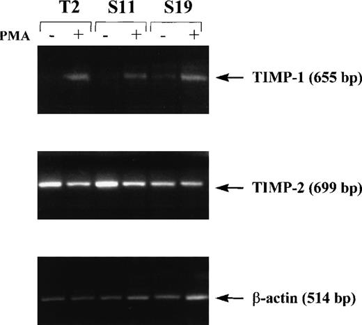 Fig. 2. Expression of TIMP-1 and TIMP-2 in lymphoma cells. / Cells were cultured in the absence (−) or presence (+) of 50 nM PMA for 12 hours. Induction of TIMP-1 and TIMP-2 was measured by reverse transcriptase-polymerase chain reaction. Results are representative of 2 independent experiments.