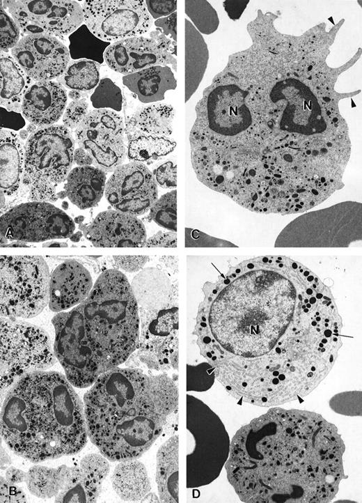 Fig. 7. Electron micrographs of bone marrow cells from a myelokathexis patient 2 during granulocyte colony-stimulating factor treatment. / (A) Low-magnification image of bone marrow shows numerous differentiated neutrophils. Magnification ×3750. (B) Mature neutrophils in bone marrow observed at higher magnification appear normal and show negligible evidence of apoptosis. Magnification ×5000. (C) Mature neutrophil shows typical microvillar structures (arrowheads) on the cell surface. Nuclear lobes (N) appear normal and show regular chromatin distribution. Magnification ×7000. (D) Mature neutrophil (bottom) and promyelocyte (top) in the bone marrow. The promyelocyte contains extensive rough endoplasmic reticulum (arrowheads) and electron-dense granules (arrows). N, nucleus. Magnification ×7000.