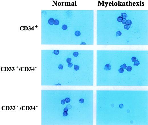 Fig. 5. Immunocytochemical detection of bcl-x expression in CD34+, D33+/CD34−, CD34−/CD33− hematopoietic subpopulations purified from bone marrow of patient 2 and a healthy volunteer.