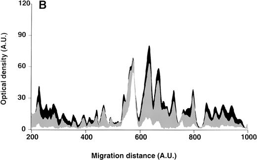 Fig. 2. Patterns of reactivity of IgG purified from plasma of patients and healthy blood donors with self-antigens. / IgG purified from plasma of patients with WAIHA and healthy blood donors was interacted at 200 μg/mL with self-antigens, as described in Materials and Methods. The figure depicts the mean densitometric profiles of reactivity of purified IgG (i.e., the arithmetic mean of the recorded intensities constituting the reactivity profile of each individual) of 20 patients with WAIHA (black area) and 20 healthy blood donors (gray area) with antigens in soluble extracts of normal RBCs (A) and normal stomach (B). White areas depict the pattern observed in the presence of secondary anti-Fcγ antibody alone. Optical densities and migration distances are expressed as arbitrary units (AU). Migration distances of 200, 600, and 1000 AU correspond to molecular weights of 200, 65, and 20 kDa, respectively.