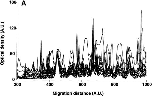 Fig. 5. Patterns of reactivity of IgM of patients and healthy blood donors with self-antigens. / The densitometric profiles of reactivity of IgM with antigens in kidney (A,B) and RBC (C,D) extracts are depicted as individual profiles (black curves) in the case of 20 patients with WAIHA (A,C) and as individual profiles (black curves) in the case of 20 healthy donors (B,D). Gray areas show the densitometric pattern observed in the presence of the secondary anti-Fcμ antibody alone. Optical densities and migration distances are expressed as arbitrary units (AU). Migration distances of 200, 600, and 1000 AU correspond to apparent molecular weights of 200, 65, and 20 kDa, respectively.
