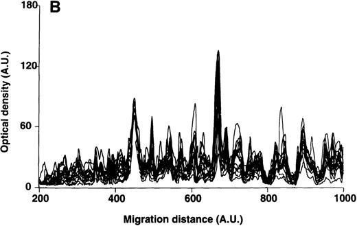 Fig. 5. Patterns of reactivity of IgM of patients and healthy blood donors with self-antigens. / The densitometric profiles of reactivity of IgM with antigens in kidney (A,B) and RBC (C,D) extracts are depicted as individual profiles (black curves) in the case of 20 patients with WAIHA (A,C) and as individual profiles (black curves) in the case of 20 healthy donors (B,D). Gray areas show the densitometric pattern observed in the presence of the secondary anti-Fcμ antibody alone. Optical densities and migration distances are expressed as arbitrary units (AU). Migration distances of 200, 600, and 1000 AU correspond to apparent molecular weights of 200, 65, and 20 kDa, respectively.