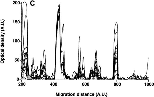 Fig. 5. Patterns of reactivity of IgM of patients and healthy blood donors with self-antigens. / The densitometric profiles of reactivity of IgM with antigens in kidney (A,B) and RBC (C,D) extracts are depicted as individual profiles (black curves) in the case of 20 patients with WAIHA (A,C) and as individual profiles (black curves) in the case of 20 healthy donors (B,D). Gray areas show the densitometric pattern observed in the presence of the secondary anti-Fcμ antibody alone. Optical densities and migration distances are expressed as arbitrary units (AU). Migration distances of 200, 600, and 1000 AU correspond to apparent molecular weights of 200, 65, and 20 kDa, respectively.