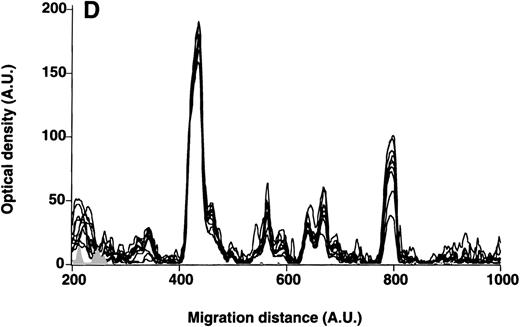 Fig. 5. Patterns of reactivity of IgM of patients and healthy blood donors with self-antigens. / The densitometric profiles of reactivity of IgM with antigens in kidney (A,B) and RBC (C,D) extracts are depicted as individual profiles (black curves) in the case of 20 patients with WAIHA (A,C) and as individual profiles (black curves) in the case of 20 healthy donors (B,D). Gray areas show the densitometric pattern observed in the presence of the secondary anti-Fcμ antibody alone. Optical densities and migration distances are expressed as arbitrary units (AU). Migration distances of 200, 600, and 1000 AU correspond to apparent molecular weights of 200, 65, and 20 kDa, respectively.