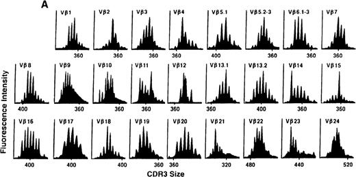 Fig. 1. The pretransplant TCR Vβ repertoire of 1 donor (A) and recipient (B) pair.