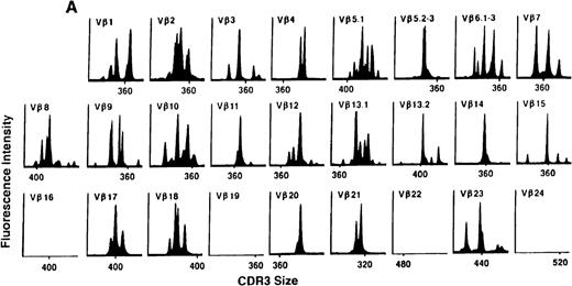 Fig. 4. TCR Vβ repertoire profiles for patient 7 at (A) 3 months, (B) 6 months, and (C) 3 years after transplant.