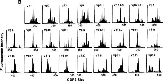 Fig. 4. TCR Vβ repertoire profiles for patient 7 at (A) 3 months, (B) 6 months, and (C) 3 years after transplant.