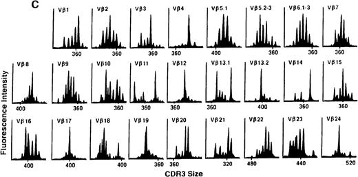 Fig. 4. TCR Vβ repertoire profiles for patient 7 at (A) 3 months, (B) 6 months, and (C) 3 years after transplant.