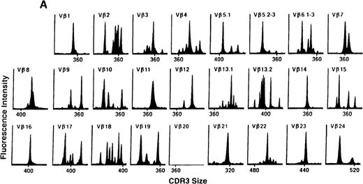 Fig. 5. TCR Vβ repertoire profiles of patient 3 at (A) 3 months, (B) 6 months, and (C) 3 years after transplant.