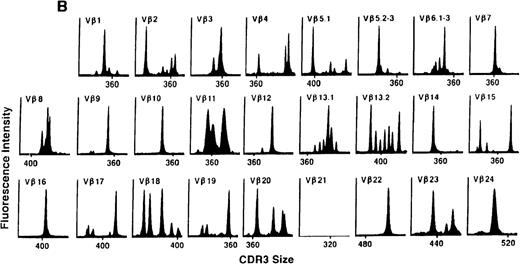 Fig. 5. TCR Vβ repertoire profiles of patient 3 at (A) 3 months, (B) 6 months, and (C) 3 years after transplant.
