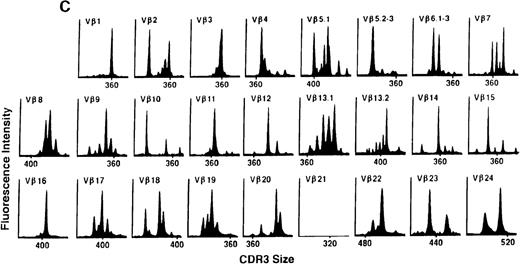 Fig. 5. TCR Vβ repertoire profiles of patient 3 at (A) 3 months, (B) 6 months, and (C) 3 years after transplant.