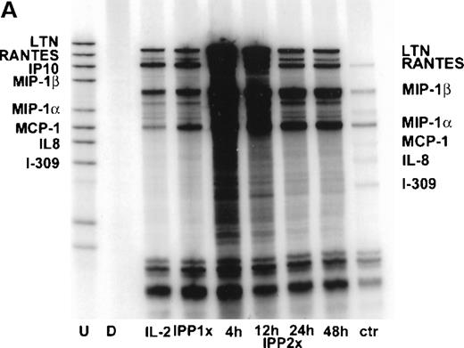 Fig. 5. Chemokine mRNA expression induced by IPP in IPP-expanded Vδ2+ T cell lines as determined by RPA. / Vδ2+ T cell lines were established by culturing PBMCs from a healthy donor for 4 weeks in vitro, following a single stimulation with IPP (IPP 1 × ). A population of the same PBMCs was also maintained in IL-2 alone (IL-2). The cells that had been stimulated 4 weeks previously were then stimulated again with IPP (IPP 2 × ), and RNA was extracted at 4, 12, 24, and 48 hours post-stimulation. (A) The result of the RPA analysis for chemokine mRNA expression using a multiprobe RPA system (hCK5). The undigested probe set (U) and the digested probe set (D) are shown in the first 2 lanes respectively, and the control RNA (ctr) provided with the kit is shown in the extreme right-hand lane. (B) Quantitative analysis of the bands by phosphoimaging are shown and are expressed as a ratio of the gene of interest to the sum of the housekeeping genes L32 and GAPDH. Data shown are representative of 3 different healthy donors.