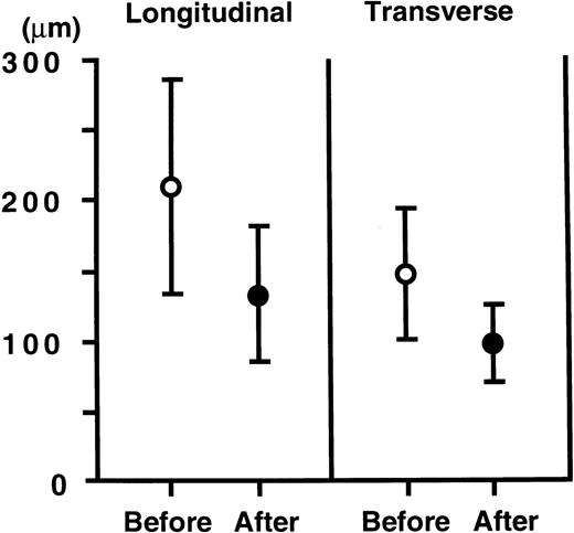 Fig. 4. Changes in longitudinal and transverse diameters of the germinal centers. / Open circles indicate mean diameters of germinal centers before treatment (n = 109) and closed circles indicate those after treatment (n = 15). The points and vertical bars indicate mean and SDs, respectively. Both the longitudinal and transverse diameters significantly decreased (P < 0.005, P < 0.001, respectively).