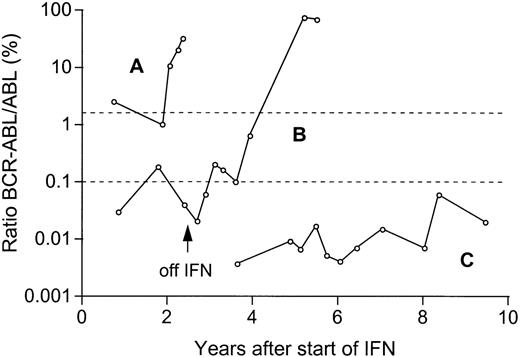 Fig. 3. Molecular monitoring in 3 representative patients in CR on IFN therapy. / In patient A, a transient complete cytogenetic response was followed by a hematologic, cytogenetic, and molecular relapse. In patient B, relapse occurred after withdrawal of IFN because of adverse effects. Patient C is in stable complete cytogenetic remission with very low ratios BCR-ABL/ABL 10.4 years after initiation of IFN therapy. The upper dotted line indicates the levels of 2% BCR-ABL/ABL at which cytogenetic relapse is expected,9 and the lower dotted line (0.1% BCR-ABL/ABL) the median ratio of all samples of patients investigated in CR.