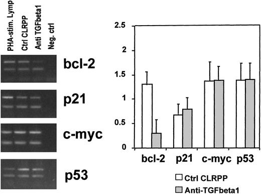 Fig. 4. Levels of bcl-2, p53, c-myc, and p21. / RT-PCR analysis of bcl-2, p21, c-myc, and p53 was performed on 72-hour cultured CLRPP in the presence (anti–TGF-beta1) or the absence (Ctrl CLRPP) of anti-TGF-β1 mAb (10 μg/mL). Panels are photographs of ethidium bromide–stained gels. (PHA-stim.LymP indicates PHA-stimulated lymphocytes used as positive control; Neg.ctrl, no-sample negative control). The lower band in all panels is aldolase-A, which was coamplified with the other specific products and used as an internal control. Data are representative of 4 experiments. Parallel cultures in the presence of irrelevant isotype-matched mouse immunoglobulins showed comparable results to those observed in control CLRPP cultures. The bar graph shows the mean values ± SD expressed as the adsorbance ratios between the specific RNA and aldolase-A RNA level observed from 4 different experiments. P > .05 for p21, c-myc, and p53 RNA levels; P < .0001 for bcl-2 RNA levels.