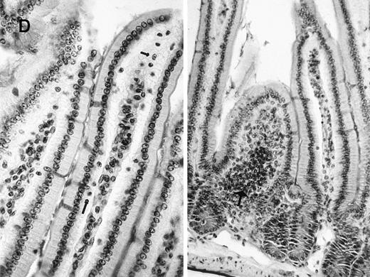Fig. 2. Characterization of splenic and gut lymphocytes from γc-transduced mice. / Flow cytometric analysis of splenocytes using (A) FITC-conjugated anti-CD8 and PE-conjugated anti-CD4 antibodies or (B) FITC-conjugated anti-immunoglobulin D (IgD) and PE-conjugated anti-IgM antibodies. (C) Analysis of hepatic lymphocytes using FITC-conjugated anti-DX5 (natural killer cell specific) and PE-conjugated anti-TCRαβ antibodies. Positive cells are expressed as percentage of gated lymphocytes. (D) Representative sections of small bowel epithelium in a γc-transduced mouse (Periodic Acid Shiff staining, × 250). Intraepithelial lymphocytes (arrows), normal cellularity of the lamina propria, and lymphoid cryptopatches (large arrow) were identified that were indistinguishable from control γc+ animals16 (and data not shown).