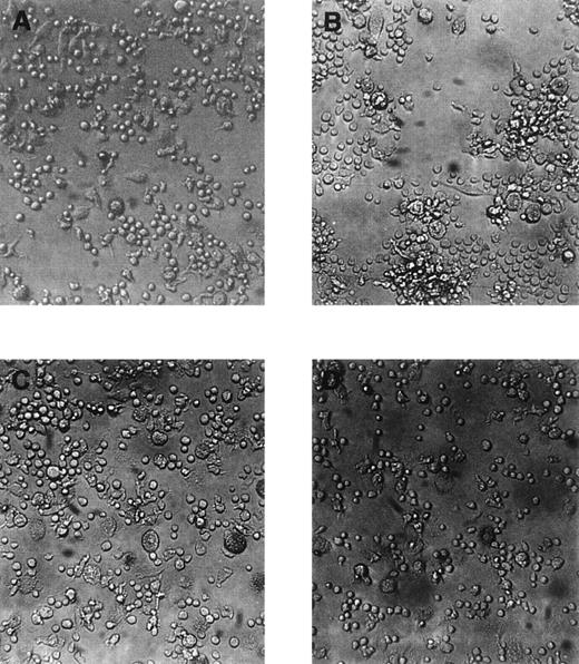 Fig. 2. Morphology of adherent cells cultured for 14 days in liquid cultures in the presence of stem cell growth factor and vascular endothelial growth factor. / All photographs are taken from the same experiment. (A) shows an area with predominant small-sized round cells and flat elongated cells, (B) cluster formation, (C) large-sized round cells with cytoplasmic granules, and (D) area with exclusively small-sized round cells. Original magnification ×100.