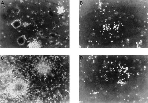 Fig. 3. Morphology of colonies generated from AC133-derived cells. / In parallel experiments, cells cultured for 8 days (day 8 cells, A and B) and 14 days (day 14 cells, C and D) in liquid cultures with stem cell growth factor (SCGF) and vascular endothelial growth factor (VEGF) were transferred to methylcellulose and stimulated either with the hematopoietic growth factor combination SCF, interleukin 3 (IL-3), IL-6, granulocyte colony-stimulating factor, granulocyte-macrophage colony-stimulating factor plus erythropoietin, or with the combination of SCGF and VEGF. In response to the hematopoietic growth factors, day 8 cells formed multilineage colonies, including the formation of burst-forming unit erythroid (A); whereas under the same culture conditions, day 14 cells produced colonies that were restricted to the granulocyte-macrophage lineage (C). Colonies grown from day 8 cells and day 14 cells, respectively, under the influence of SCGF and VEGF displayed a morphology that was different of the hematopoietic colonies and were assumed to represent endothelial colonies. Original magnification ×100.