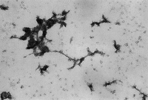 Fig. 6. Immunocytochemical analysis of colonies grown from day 8 cells in semisolid media. / Day 8 cells were cultured for 14 days in methycellulose supplemented with stem cell growth factor and vascular endothelial growth factor. Resulting colonies were then dissolved by fixation, transferred to glass slides, and stained with anti-von Willebrand factor monoclonal antibody. Original magnification ×100.