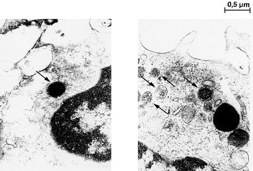 Fig. 7. Transmission electron microscopy photomicrographs of adherent cells cultured in liquid cultures with stem cell growth factor and vascular endothelial growth factor for 14 days. / Single-membrane bound structures, identified as Weibel-Palade bodies, are indicated by arrows. Magnification × 30,000.