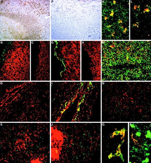 Fig. 5. The distribution of CD164 class I and II epitopes in postnatal tissue sections. / 105A5 class I Mab staining of frozen sections of human child tonsil (A, B, K, M) and thymus (D, E, L, N) is compared with 103B2/9E10 class II Mab staining of tonsil (F, G) and thymus (I, J, O, P). Staining of tonsil using the immunoperoxidase technique revealed a sub–pan-reactive labeling with 105A5, with lymphoid cells and macrophages positive (A), while with 103B2/9E10 only the endothelia are stained (F). Dual immunofluorescence with the 105A5 (B, D, E), 103B2/9E10 (G, I, J), or isotype-matched mIgM (C) or mIgG3 (H) Mabs (green) and anticytokeratin (red) demonstrates that the basal layer epithelium of tonsil (G) and the subcapsular epithelium of thymus (I) coexpress the 103B2/9E10 epitope and cytokeratin, while medullary epithelium are cytokeratin-positive but 103B2/9E10-negative (J). Cytokeratin-positive epithelia in tonsil (B) and in the thymic subcapsular (D) and medulla (E) were 105A5-negative. 105A5 (red) clearly stained CD68- (green) positive macrophages in tonsil (K) and in the thymus, as illustrated for these cells at the corticomedullary junction (L). Strong double staining of CD43-positive cells (red) with 105A5 (green) and an absence of staining of blood vessel endothelia confirmed that the sub–pan-reactive staining observed with the immunoperoxidase method (A) included T cells but not endothelia (M). This was in contrast to dual labeling of thymic medulla, where cells expressed CD43 strongly but showed weak and often patchy staining with 105A5 (N). These dual-labeled cells were macrophages. In contrast to 105A5 expression, 103B2/9E10 (green) was weakly coexpressed on CD31- (red) positive blood vessel endothelia in thymus, while macrophages stained strongly with 103B2/9E10 but not with CD31 (P). In hyperplastic thymus (O), both CD31 (red) and 103B2/9E10 (green) were coexpressed on high endothelial venules. Original magnifications: (A, F) ×80; (B-E, G-J, M, N) ×240; (K, L) ×500; (O, P) ×600.