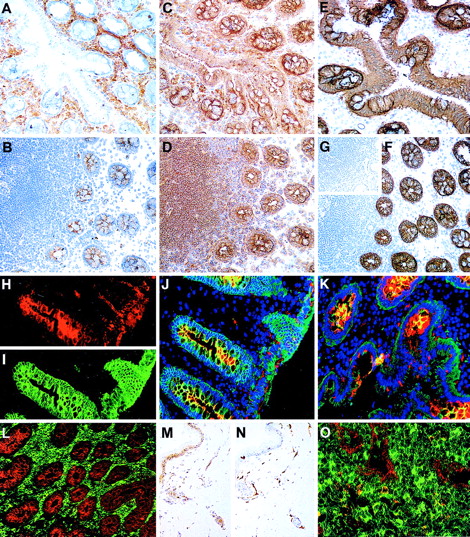 Fig. 6. The distribution of CD164 epitopes in adult nonhematopoietic tissue sections. / Frozen sections of colon stained using the immunoperoxidase technique with the 105A5 (A), 103B2/9E10 (B), N6B6 (C), and 67D2 (D) CD164 Mabs revealed that the 105A5 epitope was expressed by infiltrating lymphoid cells and macrophages in the laminar propria (A), the 103B2/9E10 epitope by vacuolar membranes of the goblet cells, with weak expression on the epithelium of the villi and crypts, and the N6B6 and 67D2 epitopes were expressed by both the 105A5- and 103B2/9E10-positive cells. The 9C4 Mab stained the vacuolar membranes of the goblet cells and the epithelium strongly, as is illustrated using the immunoperoxidase (E, F) or immunofluorescence (I) methods, while its isotype-matched control Mab, mIgG2b, was negative (inset G). Sections were triple-labeled with 103B2/9E10 (red), 9C4 (green), and DAPI (blue) for the detection of the cell nucleus using the immunofluorescence technique. Single-color analyses with 103B2/9E10 (H) confirmed that both the vacuolar membranes of goblet cells and endothelium were positive, with weaker labeling of the apical epithelium of the villi and crypts. In contrast, 9C4 did not label endothelia (I). Triple-color analyses (J, K) confirmed the strong coexpression of 103B2/9E10 and 9C4 on goblet cell vacuolar membranes (yellow). A comparison of reciprocal immunofluorescence staining of colon (L) and tonsil (O) sections with the 103B2/9E10 (red) and 105A5 (green) Mabs is shown. Double-stained cells (yellow; O) are macrophages. A skin section incubated with the 103B2/9E10 Mab demonstrates positive immunoperoxidase staining of basal epithelia and endothelia (M), while that stained with CD31 (N) shows endothelial staining only. Original magnifications: (A-G, L) ×90; (H-K) ×240; (M, N) ×70; O ×400.