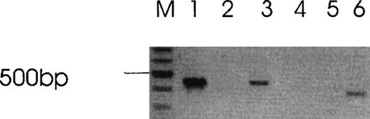 Fig. 5. Absence of PAR-4 in B16F10 cells. / Lane M (mw markers), lanes 1 to 3 (Actin), lanes 4 to 6 (PAR-4), lanes 1 and 4 (B16F10 cells), lanes 2 and 5 (water blank), lanes 3 and 6 (mouse spleen cells). Similar negative results for PAR-4 was obtained with HCT8 cells.