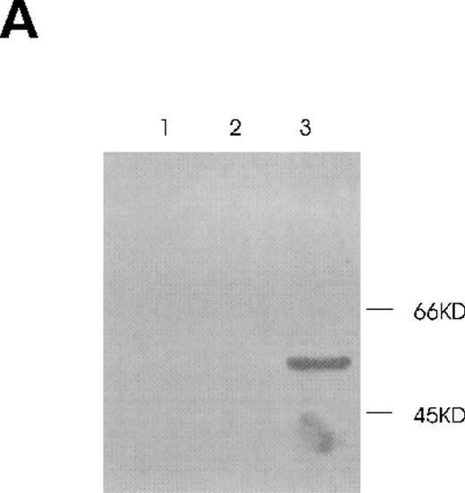 Fig. 7. Increased sensitivity of PAR-1–transfected HCT8 tumor cells to thrombin-induced impaired cell growth. / (A) Immunoblot of PAR-1 transfected cells with PAR-1–tagged anti-FLAG antibody. Lane 1, wild-type cells; lane 2, empty plasmid-transfected cells; lane 3, wild-type PAR-1 cells. (B) Wild-type PAR-1 transfectants were incubated with various concentrations of thrombin for 2 days. Control bars (black) depict empty vector transfection, whereas gray bars depict PAR-1 transfection. SEM is given for experiments performed in quadruplicate.