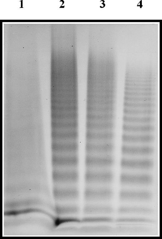 Fig. 1. Multimeric analysis of plasma vWF. / Plasma samples were electrophoresed in SDS-1.5% agarose gel, and vWF was visualized with alkaline-phosphatase–conjugated anti-vWF polyclonal antibodies. Lane 1, patient 1; lane 2, patient 2; lane 3, patient 3; lane 4, pool of normal plasma.