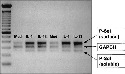 Fig. 5. IL-4 and IL-13 induce P-selectin mRNA expression in HUVEC. / Data were obtained using a semiquantitative RT-PCR method as described in “Materials and methods” to determine mRNA expression for soluble and membrane (surface)-bound P-selectin mRNA after 48-hour culture in medium, IL-4, and IL-13. The figure represents a digitally scanned image of the agarose gel. P-selectin mRNA expression was referenced to the housekeeping gene GAPDH. The cytokines induced an approximate doubling in both membrane and soluble P-selectin mRNA expression with no change in GAPDH expression. Data shown are from 2 independent experiments.