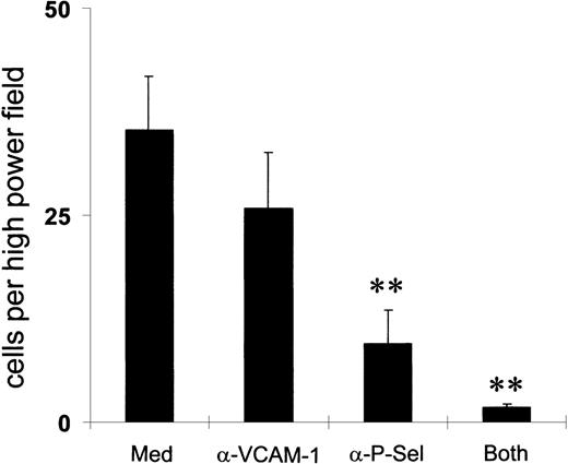 Fig. 7. P-selectin more than VCAM-1 mediates eosinophil adherence. / Endothelial cells were preincubated with mAbs against either P-selectin or VCAM-1 for 15 minutes before interaction with peripheral blood eosinophils in a parallel flow chamber assay. Total accumulation per high-power field (× 40) after a 2-minute interaction was calculated. **P < .01; n = 5-8.
