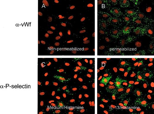 Fig. 2. Confocal images of HUVEC stained for vWF and P-selectin. / Original magnification, ×40. Staining for vWF without (A) and with (B) saponin 0.1% included with the first antibody staining buffer. Only with permeabilization was significant granular vWF staining seen. Confocal images of cells preincubated for 48 hours with medium (C) or IL-13 (50 ng/mL) after histamine (10−5 mol/L) stimulation for 10 minutes (D). A clear increase in P-selectin expression was observed.