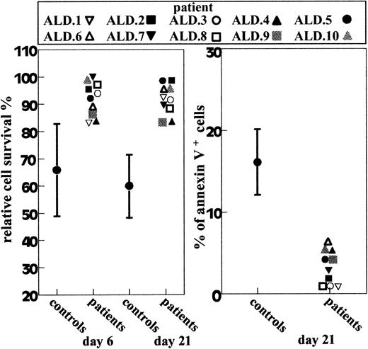 Fig. 1. Fas-induced T-cell death in ALD patients and 15 normal donors. / Left panel shows T cells cultured for 6 or 21 days with IL-2 and treated with anti-Fas mAb; relative cell survival was assessed after 18 hours. Right panel shows day-21 T-cells that were treated with anti-Fas mAb. Cell apoptosis was assessed after 6 hours by annexin V staining. Results are expressed as percentage of annexin V+ cells in the Fas-treated well corrected for the percentage of annexin V+ cells in the Fas-untreated well. The percentage of annexin V+ cells in the Fas-untreated well was always less than 10%. Results from normal donors (controls) are shown as mean ± SD.