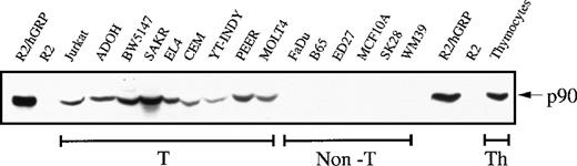 Fig. 1. RasGRP expressed in T cells. / Protein lysates were prepared from T-cell lines (T; Jurkat, human acute T-cell leukemia; ADOH, mouse T-helper cell hybridoma; BW5147, mouse T-cell lymphoma; SAKR, mouse T-cell lymphoma; EL4, mouse T-cell lymphoma; CEM, human acute T-cell lymphoblastic leukemia; YT-INDY, human NK-like T-cell leukemia; PEER, human T-cell lymphoblastic leukemia; MOLT4, human acute lymphoblastic T-cell leukemia), and from non–T-cell lines (non-T: FaDu, human pharynx squamous cell carcinoma; B65, mouse neuroblastoma; ED27, human chroriocarcinoma; MCF10A, human mammary epithelium; SK28 and WM39, human melanoma). Freshly isolated mouse thymocyctes (Th) were also examined. As controls, we studied rat2 cells and rat2 cells engineered to express RasGRP. Protein extracts were resolved by SDS/PAGE followed by immunoblotting with an antibody (H176) directed against the amino-terminus of RasGRP.